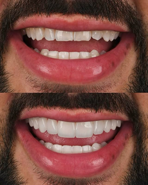 Slider image (10) Best Dental Clinic in Istanbul - Niva Aesthetic